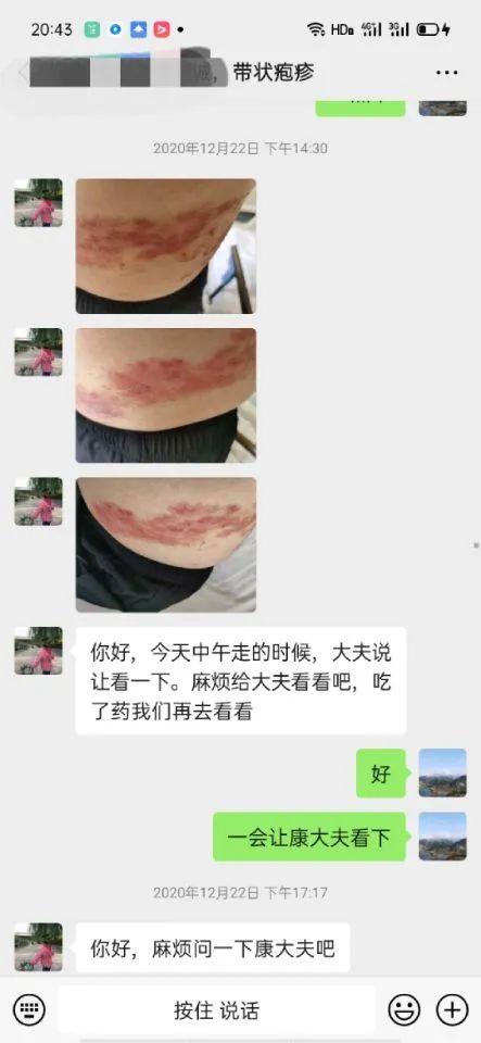 郑州管城康氏中医馆:缠腰龙——带状疱疹