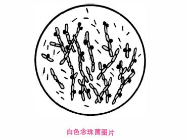 【病因及发病机制】 白色假丝酵母菌是一种寄生于阴道,口腔,肠道的