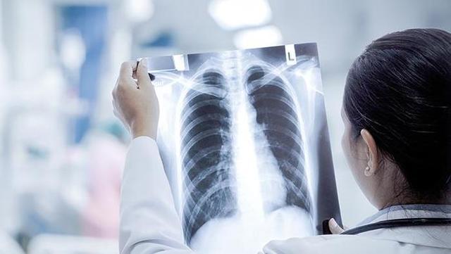 导致白肺的原因是什么?白肺如何治疗?能预防吗?对话专家
