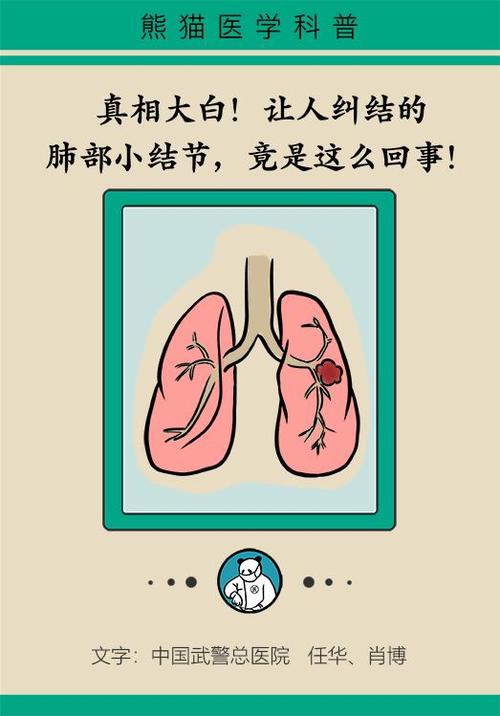 肺部小结节是肺癌前兆?听听专家怎么说!丨漫画