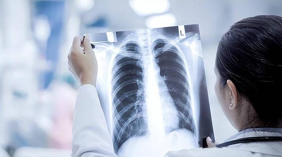 12岁孩子发热咳嗽一周被查出白肺,怎么知道自己是不是白肺呢?