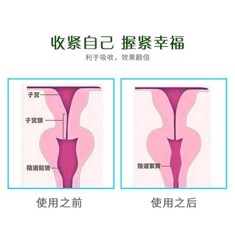 广州女性私密护理液私密紧致妇科生长因子温感液oem