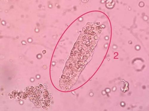 尿液管型图片分享,细胞图片分享疟原虫专辑_手机搜狐网