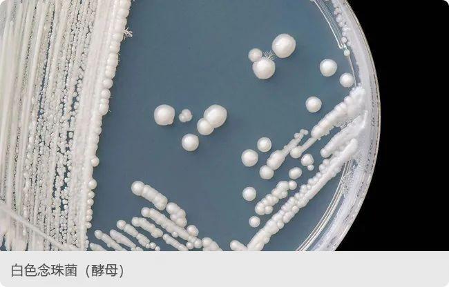 白色念珠菌,又称白假丝酵母菌,是一种条件致病性真菌,最适宜生长在ph