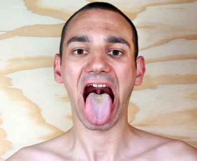 舌头发麻是怎么回事 舌头发麻有哪些治疗方法