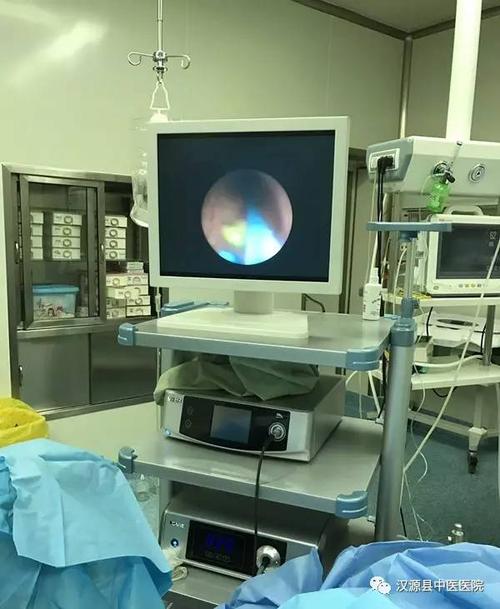 钬激光碎石术顽固结石的克星汉源县中医医院泌尿外科成功开展钬激光