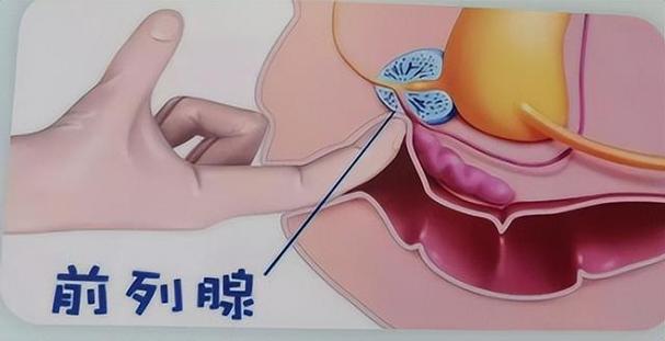 前列腺液常规检查(4)