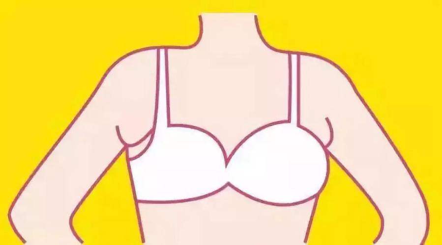 真假副乳怎么区分?如何预防?