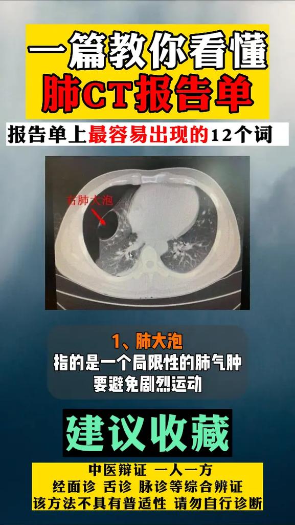 肺结节常见的12种描述,可以一一对照,有看不懂的报告,可以把 - 抖音
