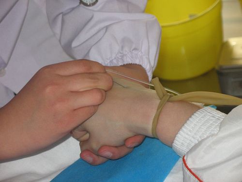 护士执业资格考试之周围静脉输液法
