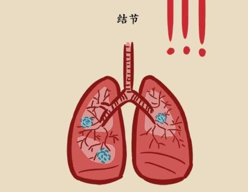 发生肺结节怎么办先别慌学会这3个护理方法或能有助肺健康