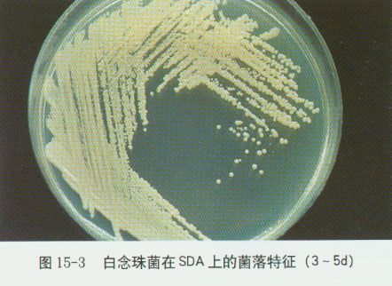 白色念珠菌在sda上的菌落特征
