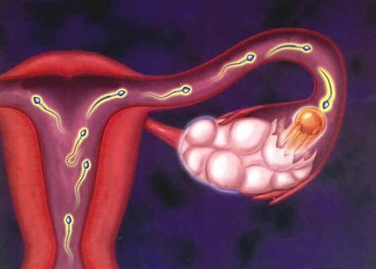 其临床特征为身矮,颈蹼和幼儿型女性外生殖器,以后亦称此类患者为 a