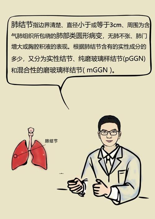 肺结节到底是不是定时炸弹漫画版中山医院呼吸科张勇